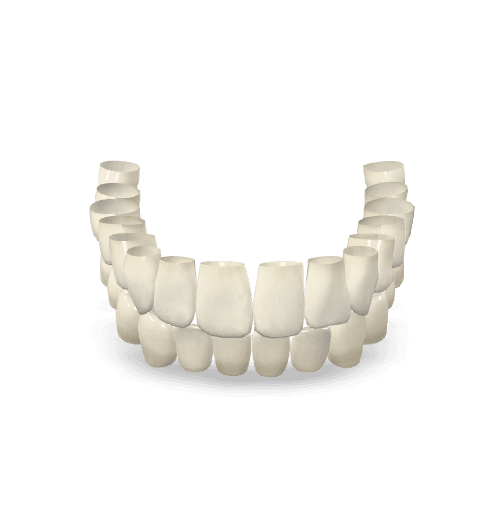 Porcelain Fused to Zirconia