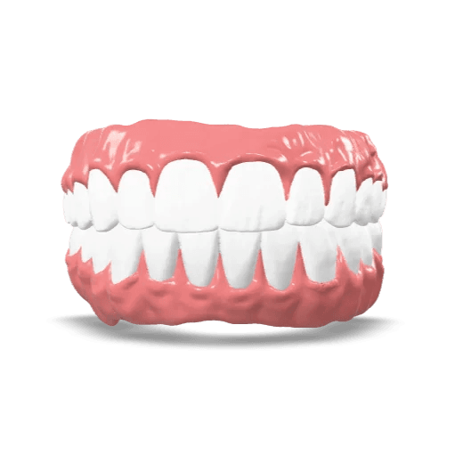 Process Implant Acrylic Denture