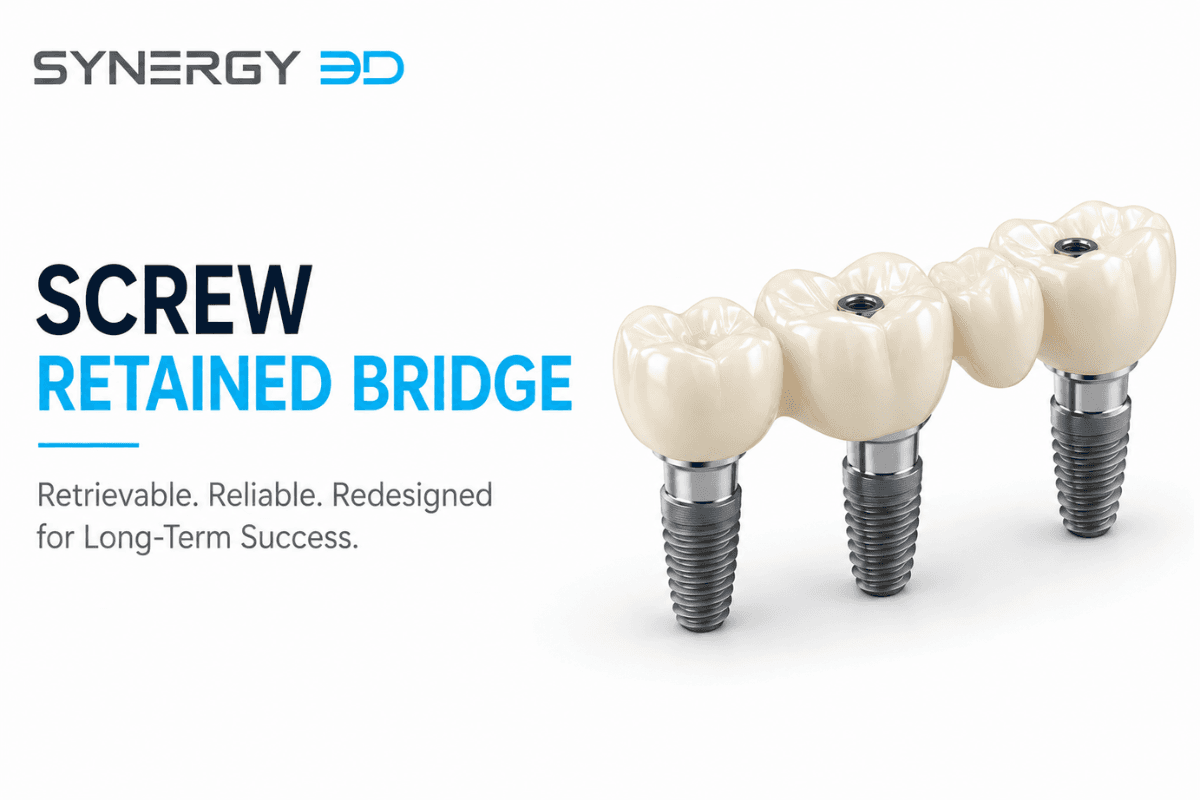 What Dentists Should Know About Screw Retained Bridges